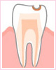 C1